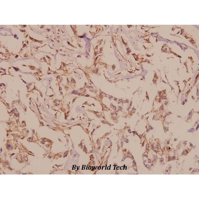 Anti-mGluR-6 (A865) Antibody from Bioworld Technology (BS1146) - Antibodies.com