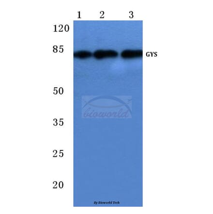 Anti-GYS (P539) Antibody from Bioworld Technology (BS1151) - Antibodies.com