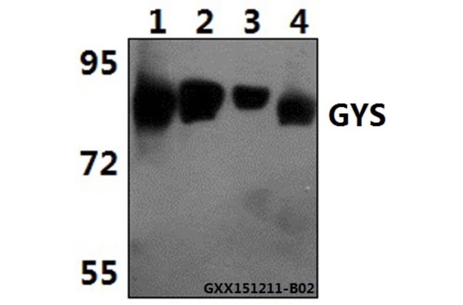 Anti-GYS (P539) Antibody from Bioworld Technology (BS1151) - Antibodies.com