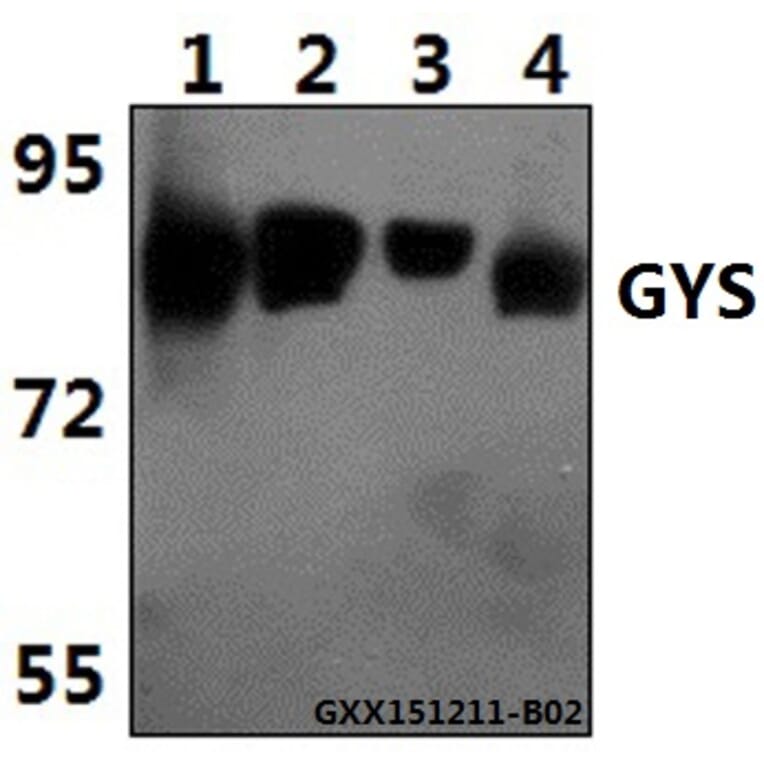 Anti-GYS (P539) Antibody from Bioworld Technology (BS1151) - Antibodies.com
