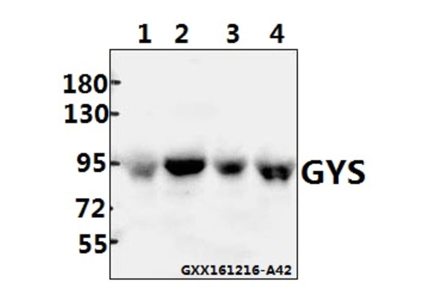 Anti-GYS (P539) Antibody from Bioworld Technology (BS1151) - Antibodies.com