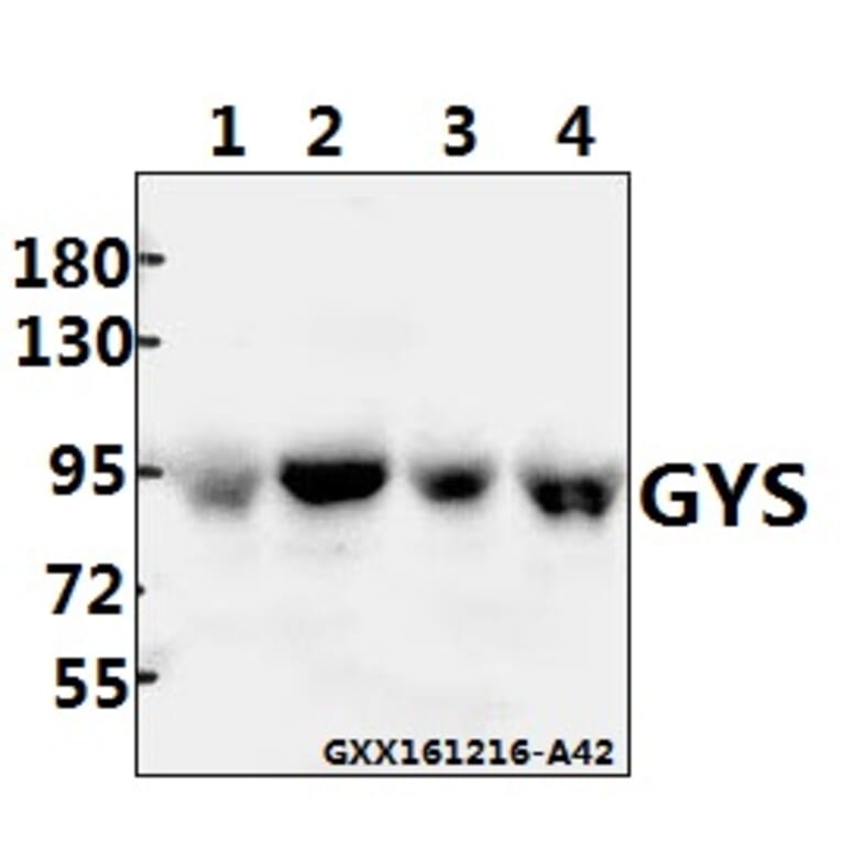 Anti-GYS (P539) Antibody from Bioworld Technology (BS1151) - Antibodies.com