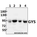 Anti-GYS (P539) Antibody from Bioworld Technology (BS1151) - Antibodies.com