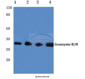 Anti-Granzyme B/H (E20) Antibody from Bioworld Technology (BS1152) - Antibodies.com