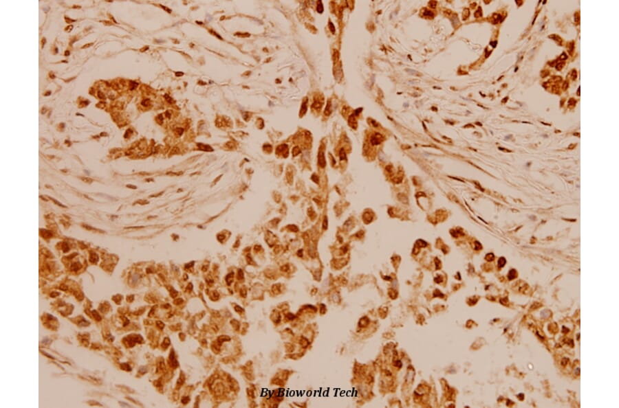 Anti-Granzyme B/H (E20) Antibody from Bioworld Technology (BS1152) - Antibodies.com