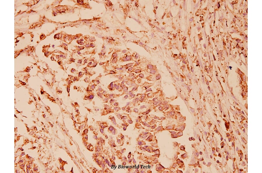 Anti-GRP78 (P641) Antibody from Bioworld Technology (BS1154) - Antibodies.com