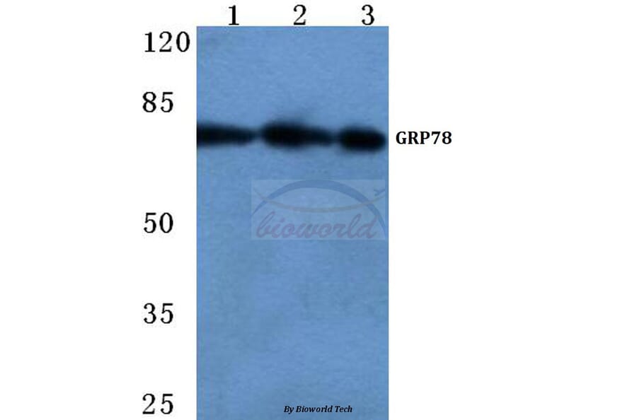 Anti-GRP78 (P641) Antibody from Bioworld Technology (BS1154) - Antibodies.com