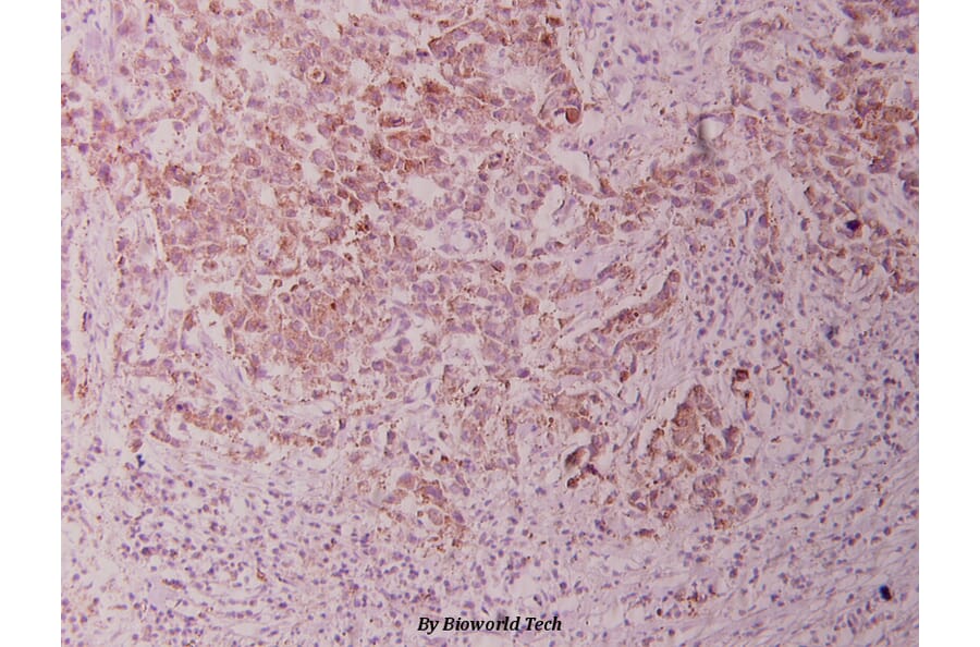 Anti-GSK3α (G15) Antibody from Bioworld Technology (BS1156) - Antibodies.com