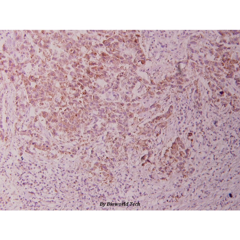 Anti-GSK3α (G15) Antibody from Bioworld Technology (BS1156) - Antibodies.com