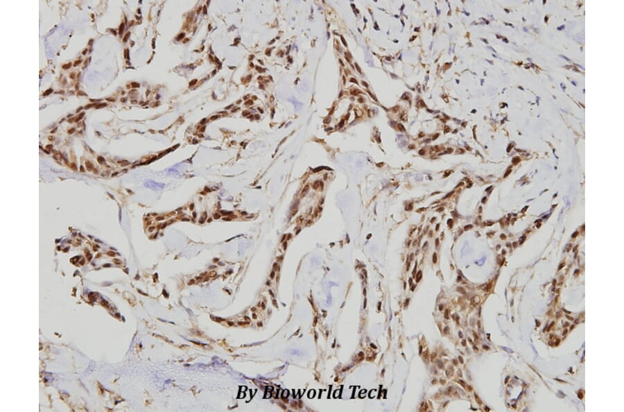 Anti-GCS-β-1 (V21) Antibody from Bioworld Technology (BS1158) - Antibodies.com