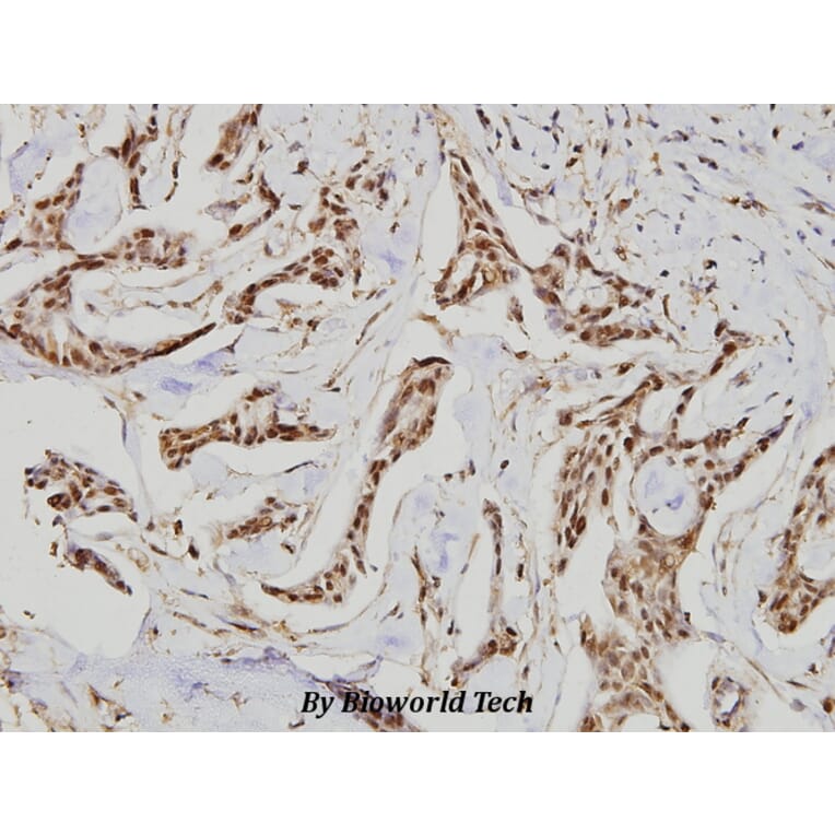 Anti-GCS-β-1 (V21) Antibody from Bioworld Technology (BS1158) - Antibodies.com