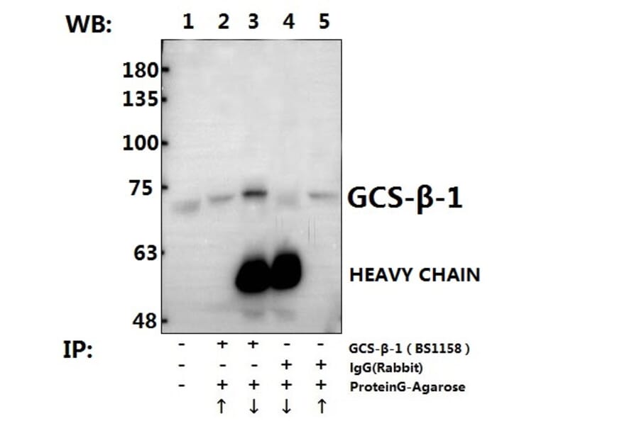 Anti-GCS-β-1 (V21) Antibody from Bioworld Technology (BS1158) - Antibodies.com