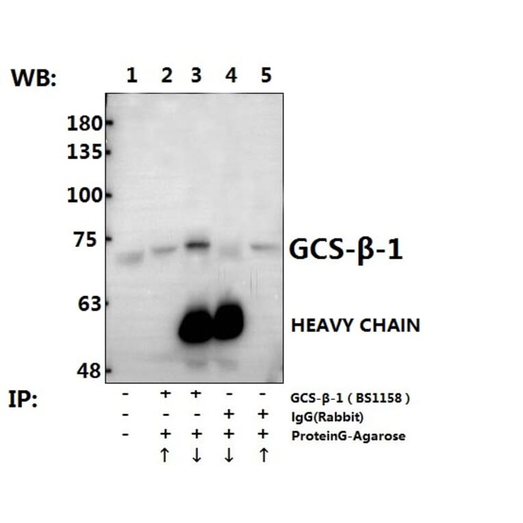 Anti-GCS-β-1 (V21) Antibody from Bioworld Technology (BS1158) - Antibodies.com