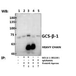 Anti-GCS-β-1 (V21) Antibody from Bioworld Technology (BS1158) - Antibodies.com