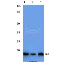 Anti-CGB (D131) Antibody from Bioworld Technology (BS1159) - Antibodies.com