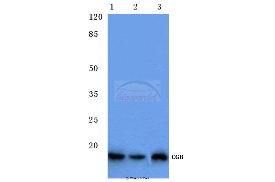 Anti-CGB (D131) Antibody from Bioworld Technology (BS1159) - Antibodies.com