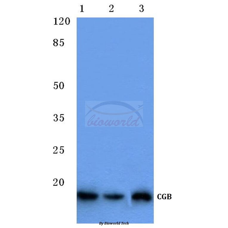 Anti-CGB (D131) Antibody from Bioworld Technology (BS1159) - Antibodies.com