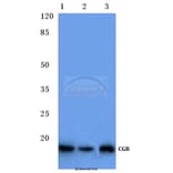 Anti-CGB (D131) Antibody from Bioworld Technology (BS1159) - Antibodies.com