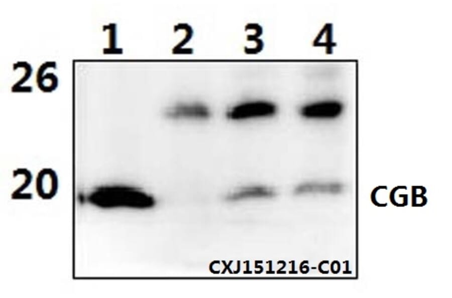 Anti-CGB (D131) Antibody from Bioworld Technology (BS1159) - Antibodies.com