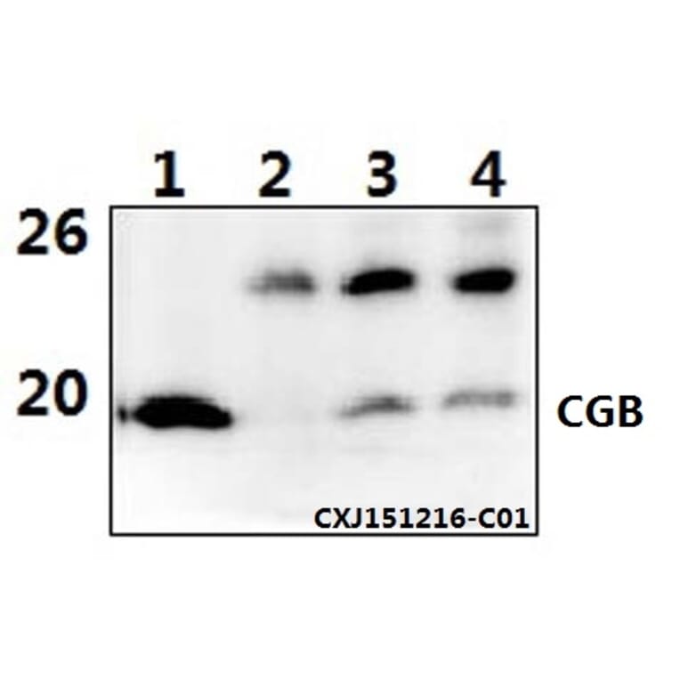 Anti-CGB (D131) Antibody from Bioworld Technology (BS1159) - Antibodies.com