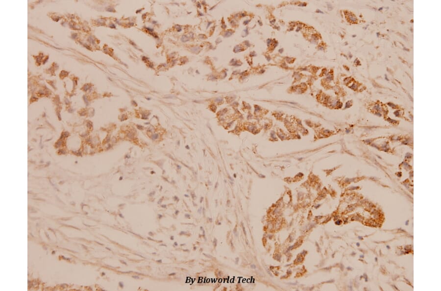 Anti-CGB (D131) Antibody from Bioworld Technology (BS1159) - Antibodies.com