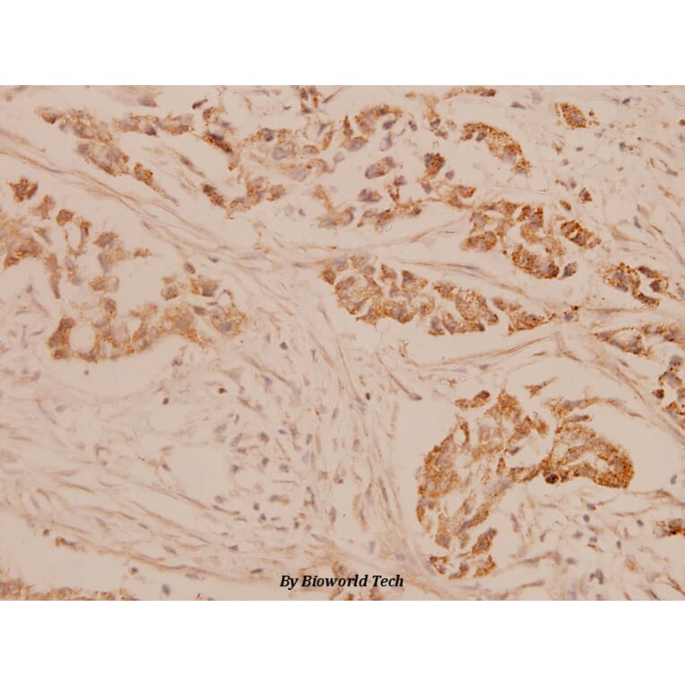 Anti-CGB (D131) Antibody from Bioworld Technology (BS1159) - Antibodies.com