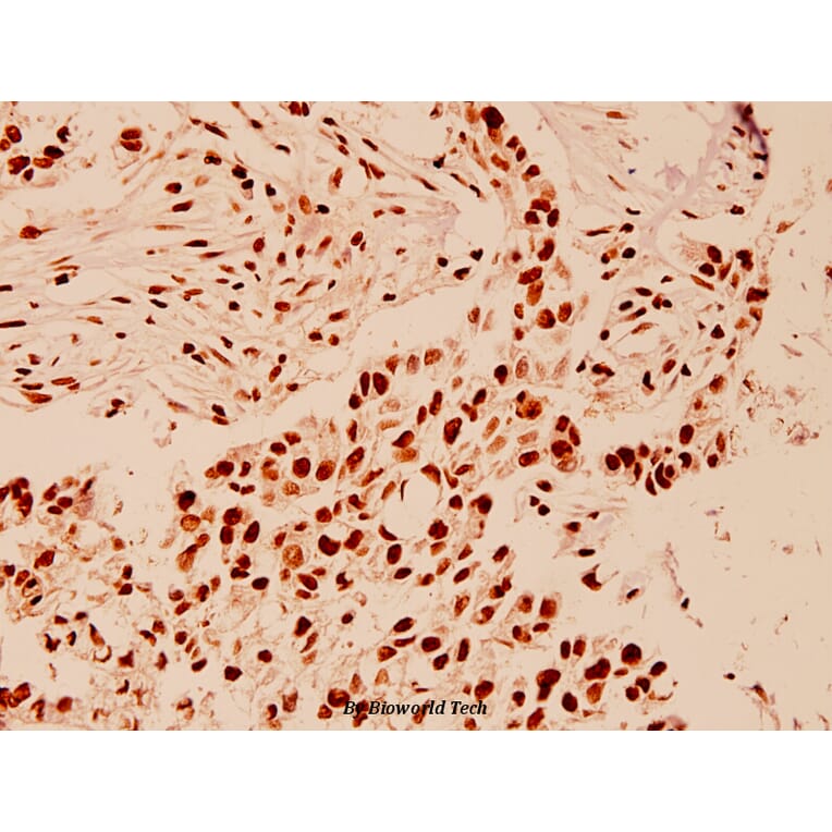 Anti-HDAC1 (E468) Antibody from Bioworld Technology (BS1160) - Antibodies.com