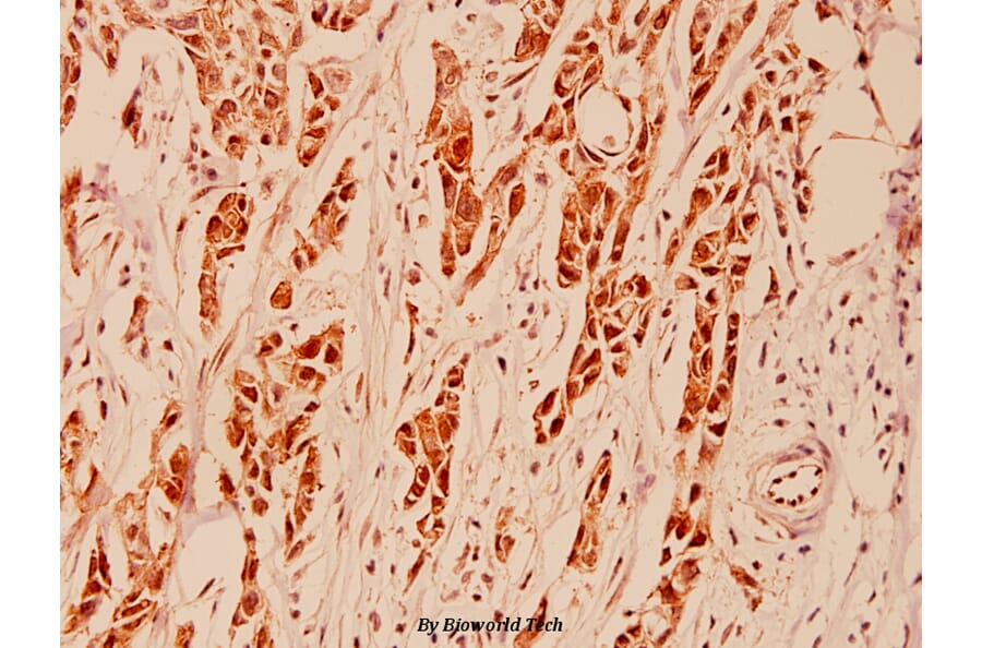 Anti-HDAC5 (P492) Antibody from Bioworld Technology (BS1164) - Antibodies.com