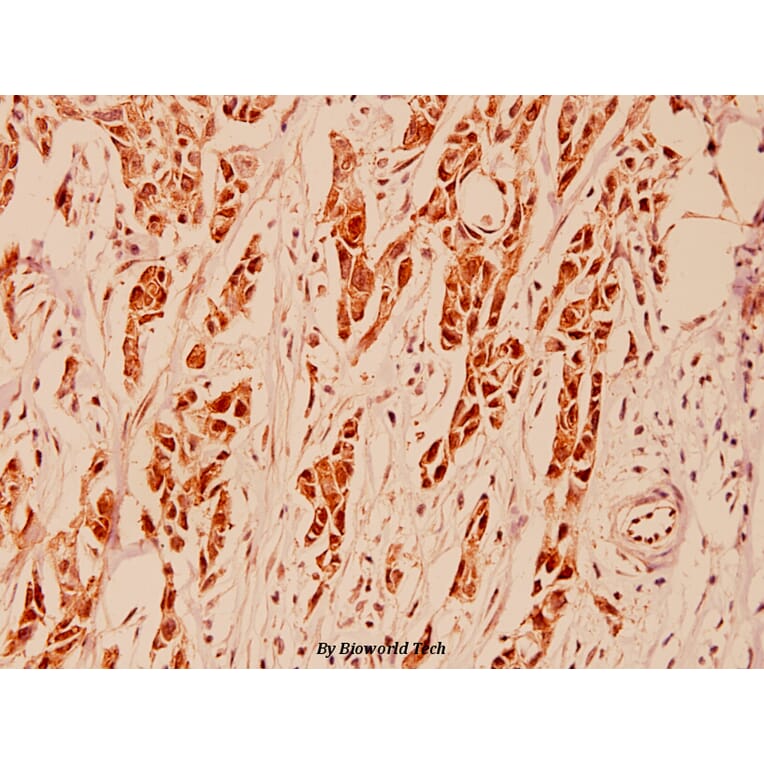 Anti-HDAC5 (P492) Antibody from Bioworld Technology (BS1164) - Antibodies.com
