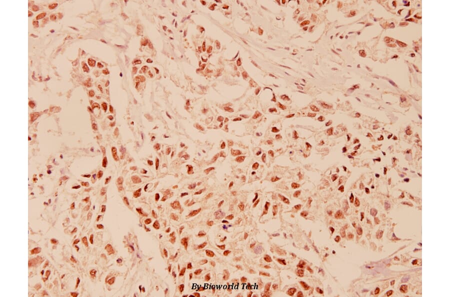 Anti-HDAC6 (H1203) Antibody from Bioworld Technology (BS1165) - Antibodies.com