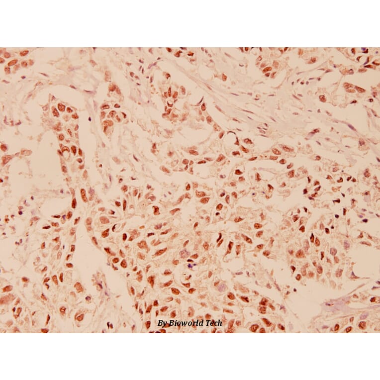 Anti-HDAC6 (H1203) Antibody from Bioworld Technology (BS1165) - Antibodies.com