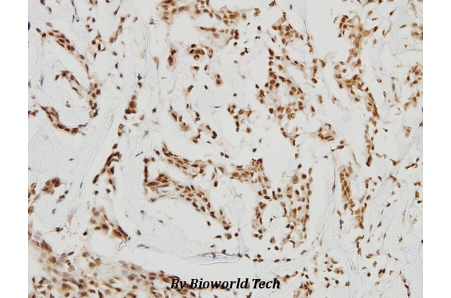 Anti-HDAC8 (K33) Antibody from Bioworld Technology (BS1167) - Antibodies.com