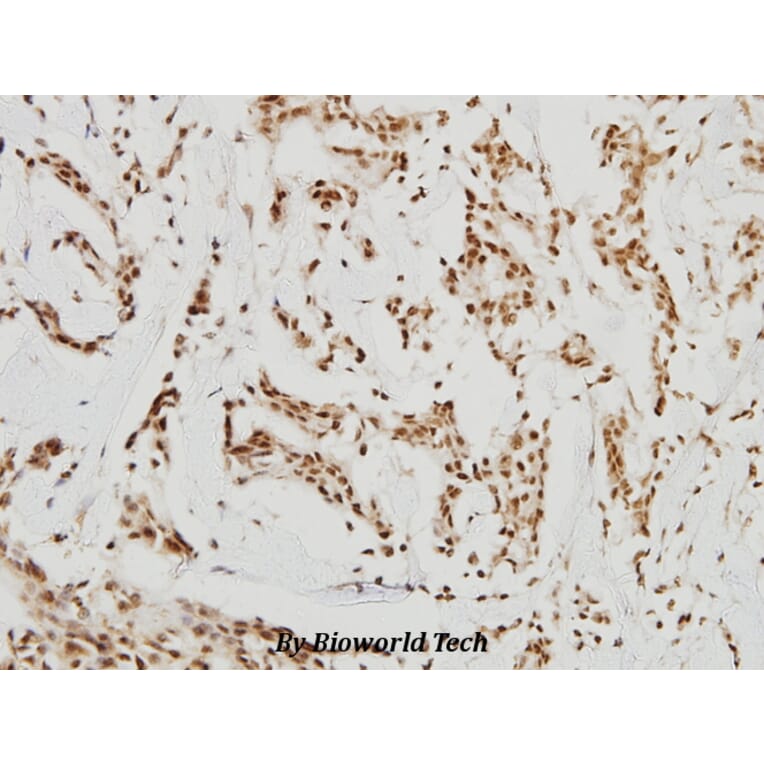 Anti-HDAC8 (K33) Antibody from Bioworld Technology (BS1167) - Antibodies.com