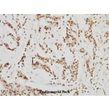 Anti-HDAC8 (K33) Antibody from Bioworld Technology (BS1167) - Antibodies.com