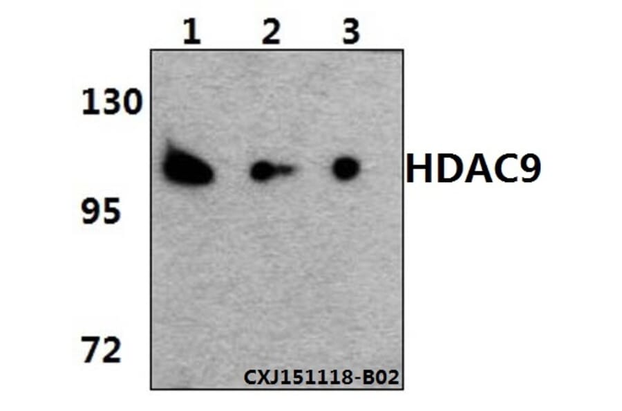 Anti-HDAC 9 (P1047) Antibody from Bioworld Technology (BS1168) - Antibodies.com