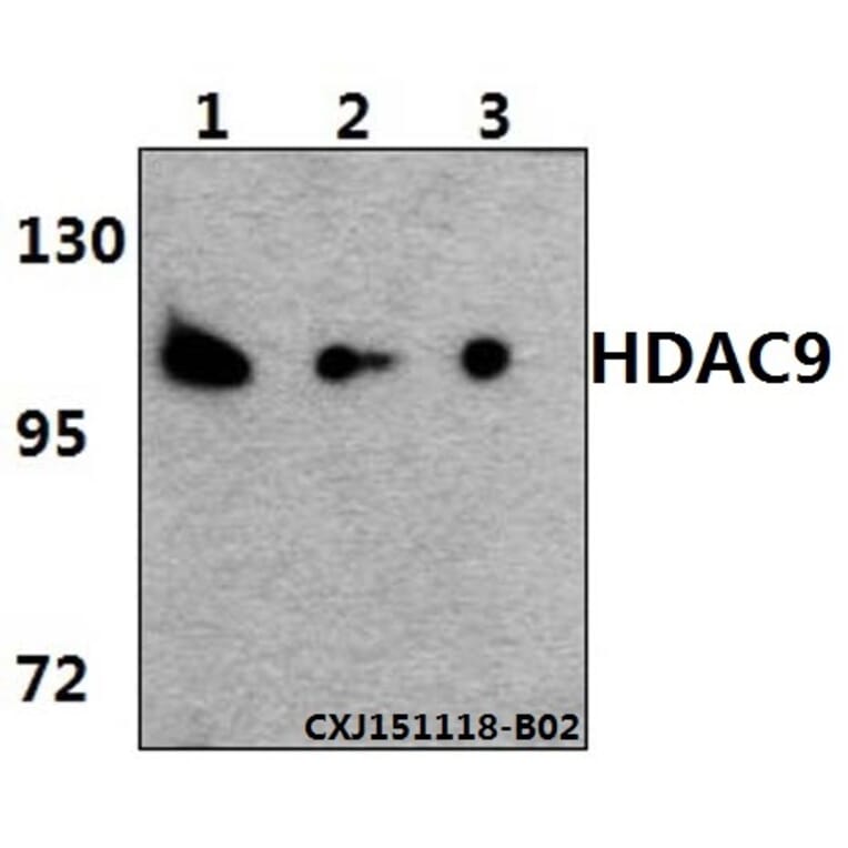 Anti-HDAC 9 (P1047) Antibody from Bioworld Technology (BS1168) - Antibodies.com