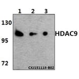 Anti-HDAC 9 (P1047) Antibody from Bioworld Technology (BS1168) - Antibodies.com