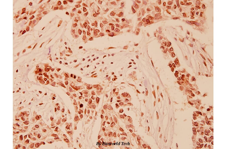 Anti-HDAC 9 (P1047) Antibody from Bioworld Technology (BS1168) - Antibodies.com