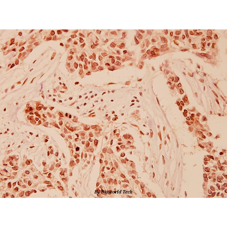 Anti-HDAC 9 (P1047) Antibody from Bioworld Technology (BS1168) - Antibodies.com