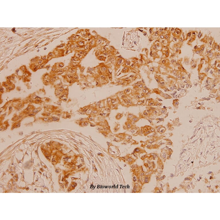 Anti-ErbB2/HER2 (T1242) Antibody from Bioworld Technology (BS1171) - Antibodies.com