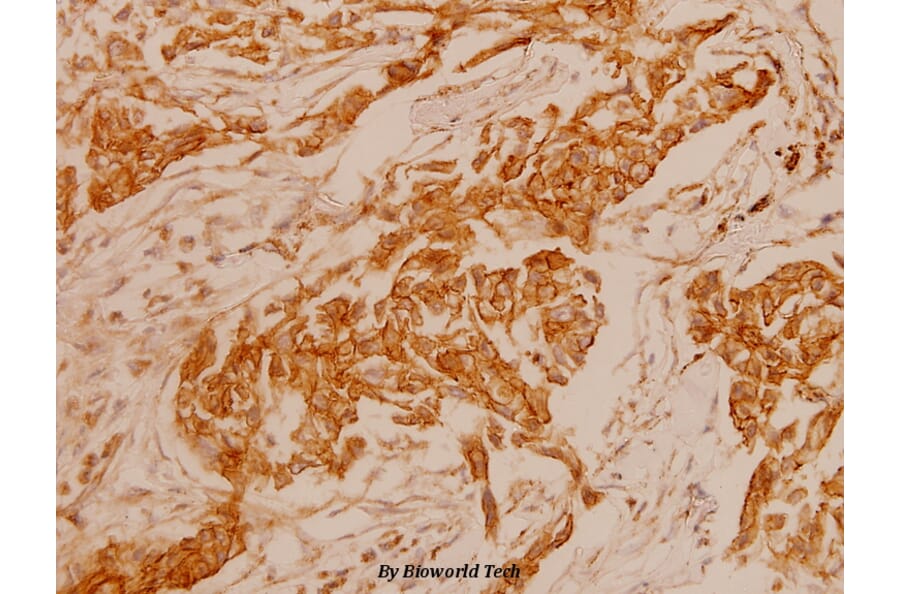 Anti-ErbB2/HER2 (D871) Antibody from Bioworld Technology (BS1172) - Antibodies.com