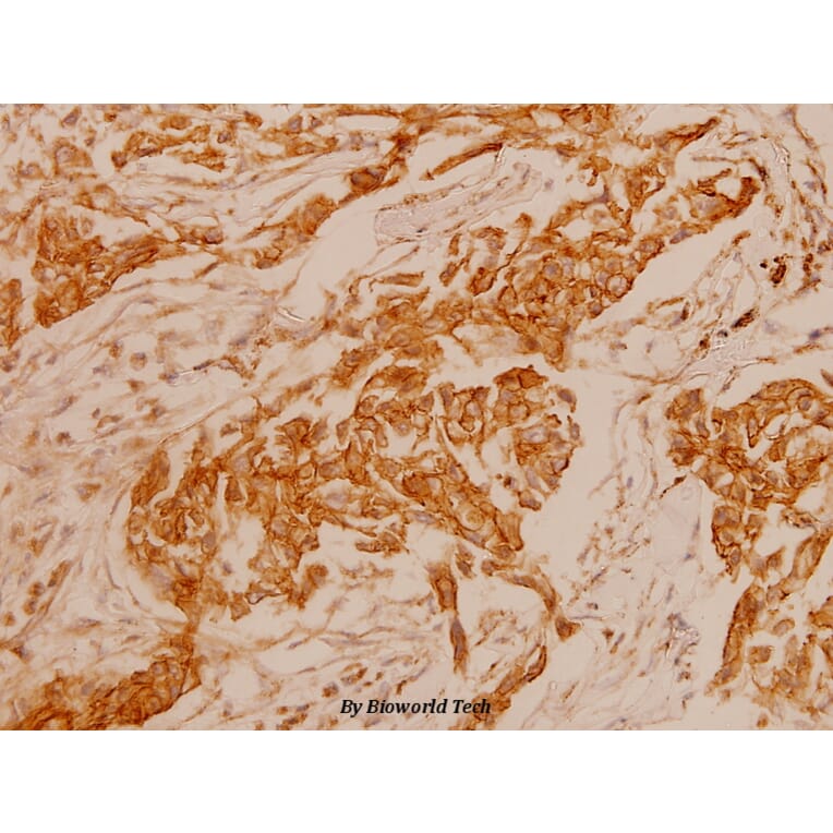 Anti-ErbB2/HER2 (D871) Antibody from Bioworld Technology (BS1172) - Antibodies.com