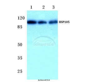 Anti-HSP105 (P819) Antibody from Bioworld Technology (BS1176) - Antibodies.com