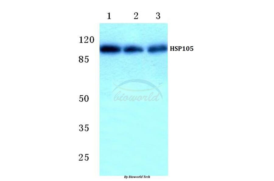 Anti-HSP105 (P819) Antibody from Bioworld Technology (BS1176) - Antibodies.com