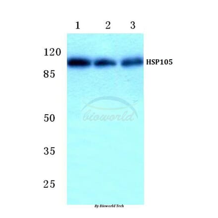 Anti-HSP105 (P819) Antibody from Bioworld Technology (BS1176) - Antibodies.com