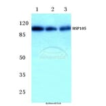 Anti-HSP105 (P819) Antibody from Bioworld Technology (BS1176) - Antibodies.com