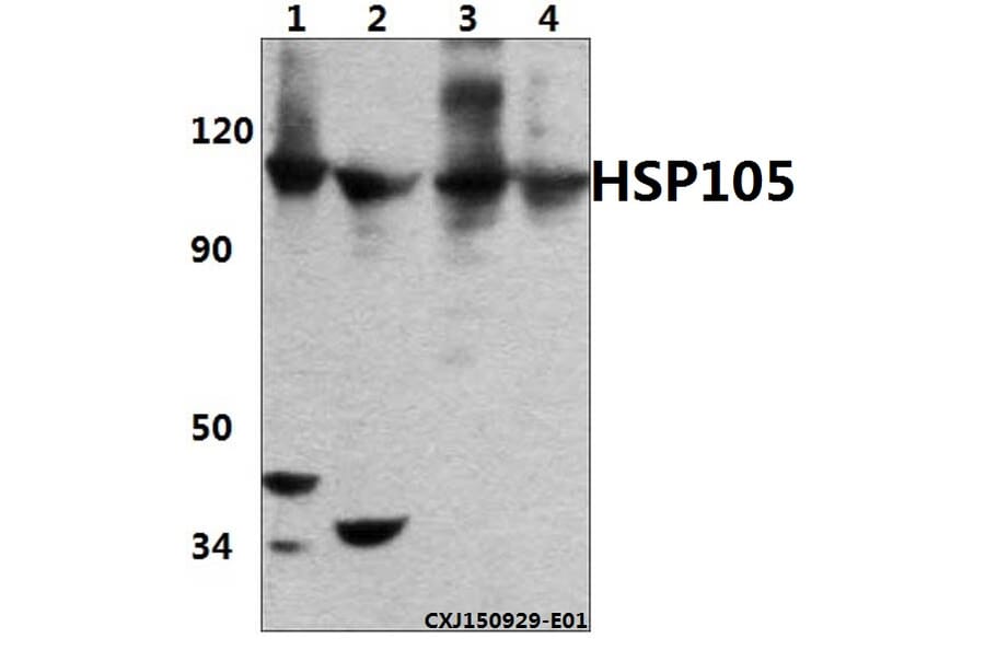 Anti-HSP105 (P819) Antibody from Bioworld Technology (BS1176) - Antibodies.com