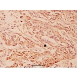Anti-HSP105 (P819) Antibody from Bioworld Technology (BS1176) - Antibodies.com