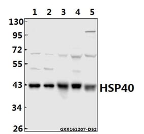 Anti-HSP40 (P303) Antibody from Bioworld Technology (BS1178) - Antibodies.com