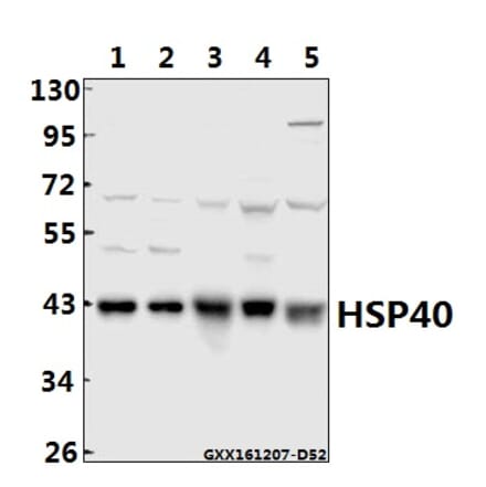Anti-HSP40 (P303) Antibody from Bioworld Technology (BS1178) - Antibodies.com